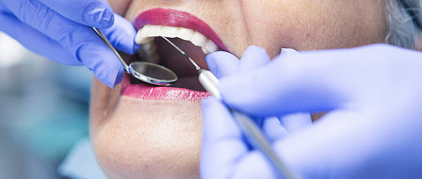 Best Cracked Tooth Emergency Dentist  in Belmont, CA